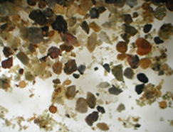 砂の中の卵胞子