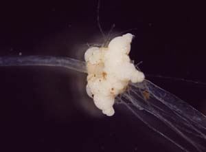 ホシツリモ球状体