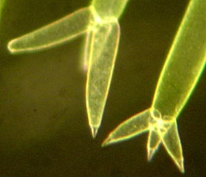 先端部拡大その１