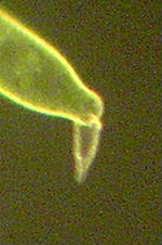 先端部拡大その３