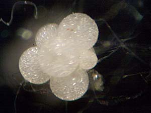 シラタマモ球状体