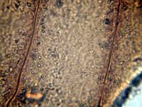 チャボフラスコモ卵胞子膜