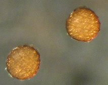 チャボフラスコモ卵胞子